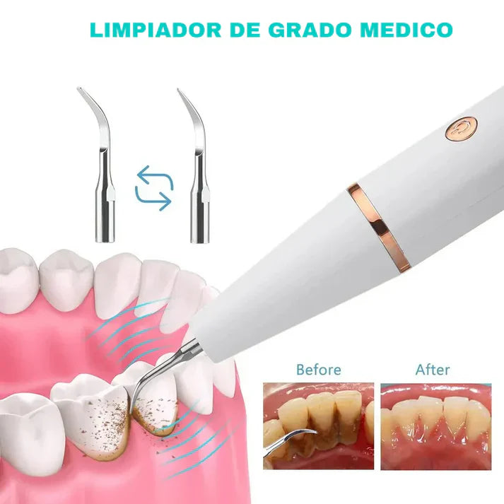 🦷 DentalClean® – Quita Sarro Eléctrico con Eliminador de Placa + Cabezal Intercambiable