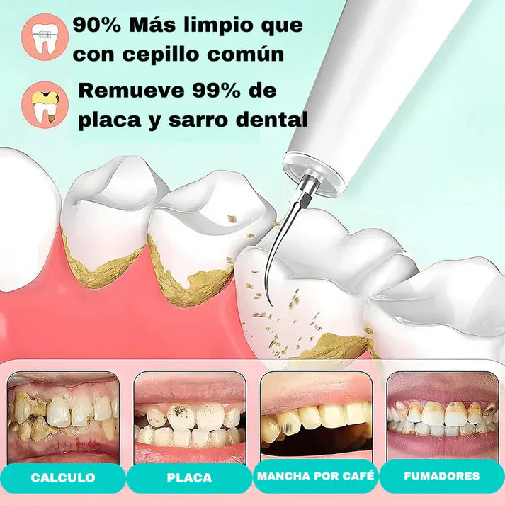 🦷 DentalClean® – Quita Sarro Eléctrico con Eliminador de Placa + Cabezal Intercambiable